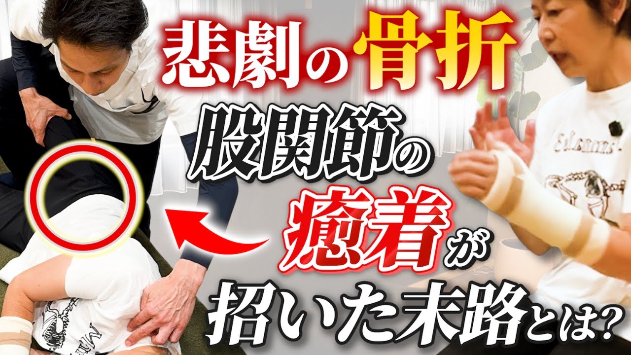 股関節の不安定感・転倒の症例動画サムネイル