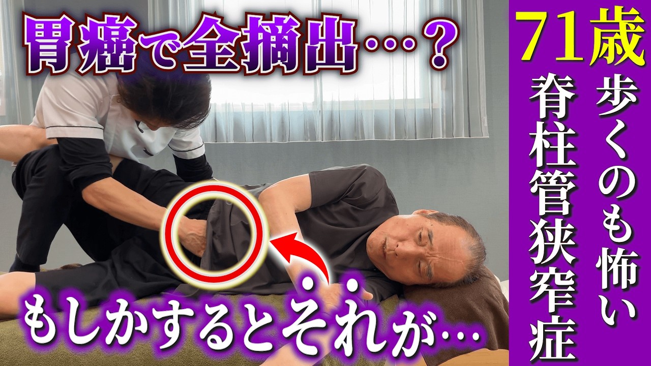 胃全摘後・脊柱管狭窄症の症例動画サムネイル