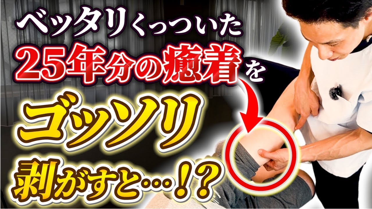 股関節痛・膝痛の症例動画サムネイル