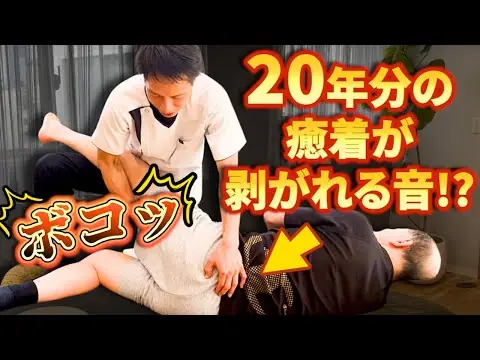 20年続く痛みの症例動画サムネイル