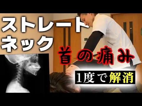 ストレートネックの症例動画サムネイル